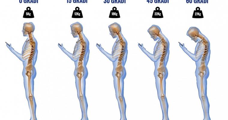 iGobba? Gli Effetti dell’uso errato dei device moderni